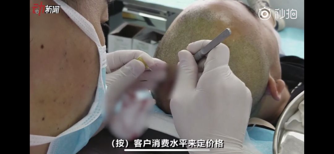 小白鼠正规吗(小白鼠骗局)